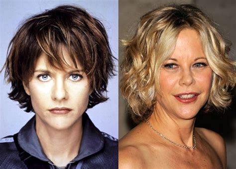 Meg Ryan Plastic Surgery Disaster