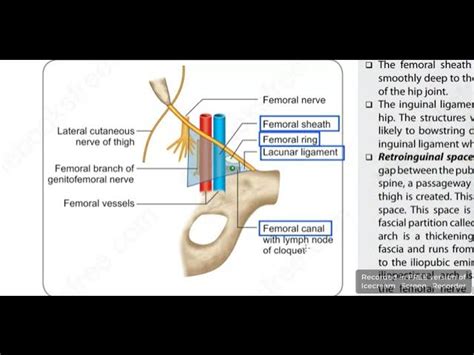 Femoral Ring Boundaries