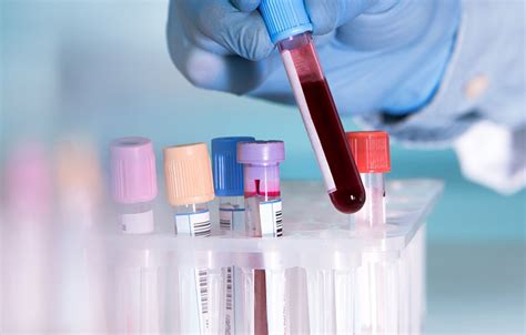 Blood tests and diagnosing illness: what can blood tell us about what’s ...