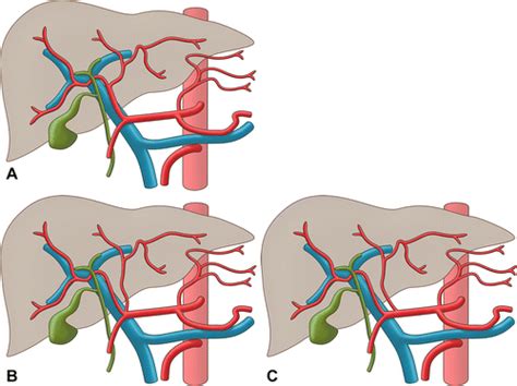 Hepatic Artery