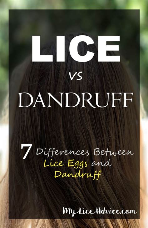 Lice vs Dandruff - 7 Key Differences Between Lice Eggs and Dandruff ...