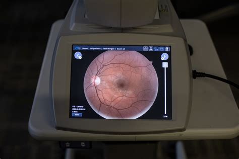 Improving Diabetic Care: A Guide to Diabetic Retinal Screenings