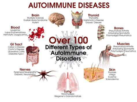 Infectious Auto-Immune Diseases Often Cause Nerve Damage | Neuropathy and HIV