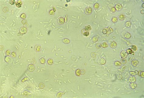 Module 8.4: Common Structures Observed on the Sediment Exam – Clinical Veterinary Diagnostic ...