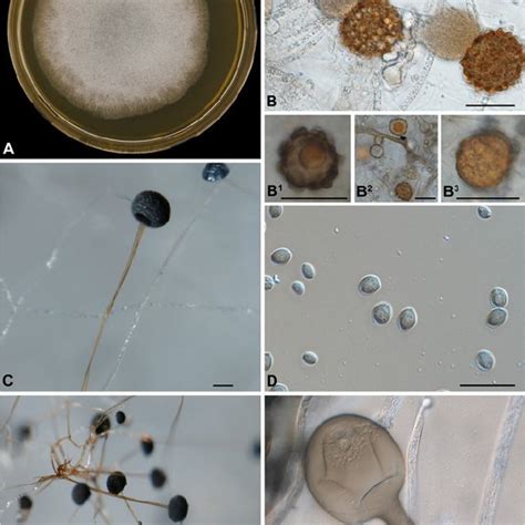 (PDF) Diversity and delimitation of Rhizopus microsporus