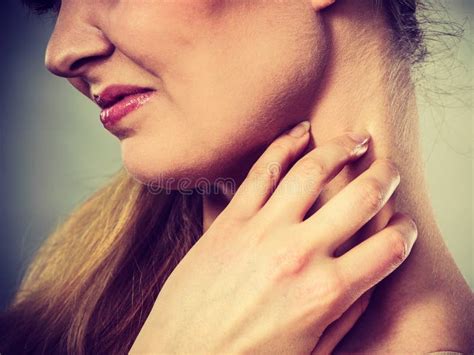 Woman Scratching Her Itchy Neck with Allergy Rash Stock Photo - Image ...