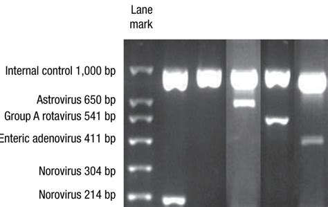 Agarose gel electrophoresis results show expected polymerase chain... | Download Scientific Diagram