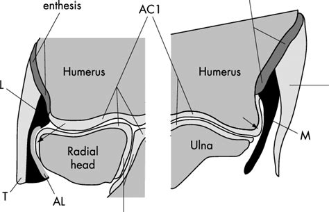 A schematic representation of the enthesis organs associated with the... | Download Scientific ...