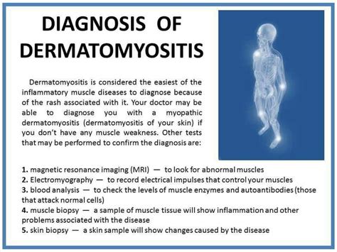 Diagnosis of Dermatomyositis Dermatomyositis Awareness, Lupus Diagnosis, Autoimmune Disease ...