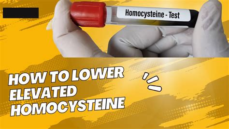 HOW TO LOWER ELEVATED HOMOCYSTEINE - YouTube