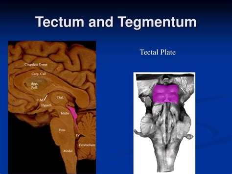 PPT - Brain Stem I PowerPoint Presentation, free download - ID:628947