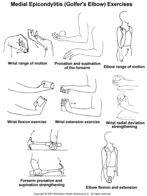 Sports Medicine Advisor 2003.1: Medial Epicondylitis (Golfer's Elbow) Exercises: Illustration