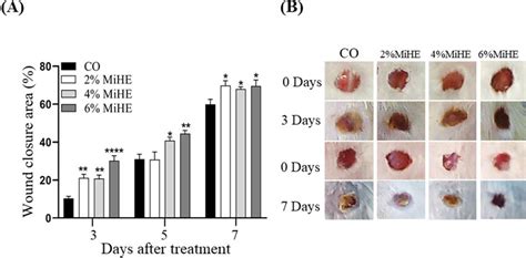 Wound closure area. (A) Graphical representation of the percentage of ...