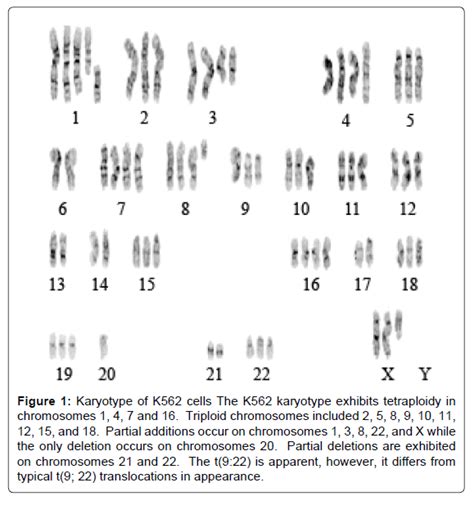 Apoptosis and Differentiation of K562 Cells by Targeting GST-O1 t