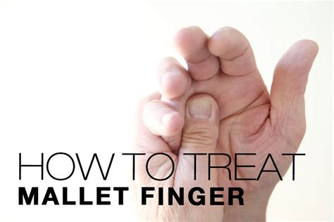 Mallet Finger: Symptoms, Causes, Treatment By WristT & Thumb Braces