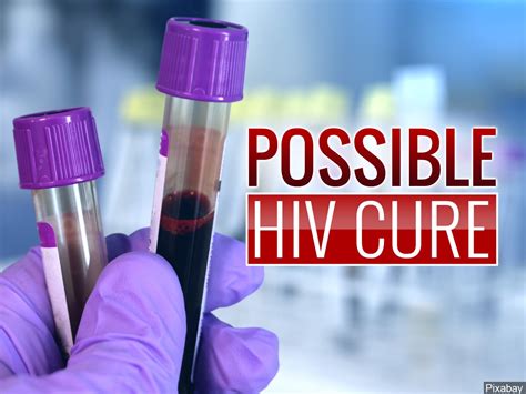 Possible HIV Cure, Study Eliminates Virus in Mice – NBC Palm Springs