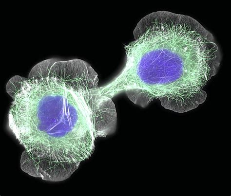 Hacat Culture Cells, Light Micrograph by Dr Torsten Wittmann