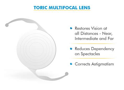 Toric Multifocal lens IOL for cataract/ Motiyabind Surgery