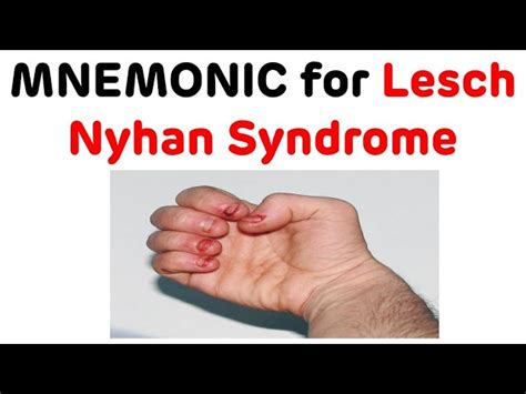 Lesch Nyhan Syndrome Mnemonic || Mnemonic To Remember Lesch, 53% OFF