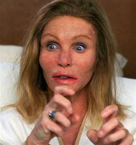 Chatter Busy: Donna Mills Plastic Surgery