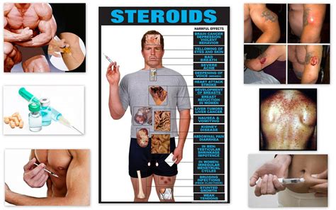 All about Steroids ~ FITNESS FREAK
