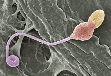 Magnification view of a deformed sperm cell under a Color scanning electron micrograph stock ...