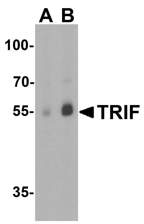 TRIF Antibody - Cat. No. 3173 | ProSci