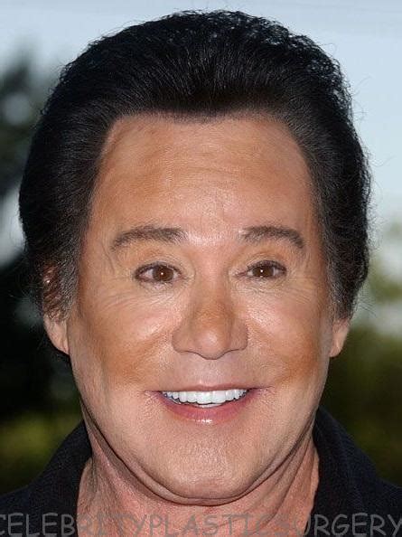 wayne-newton-botox-surgery | Wayne Newton nose job before an… | Flickr