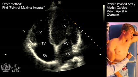 Automatic Apical View Classification Of Echocardiograms, 47% OFF