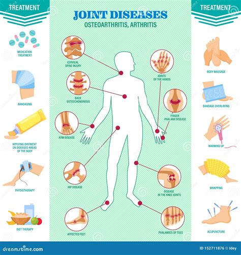 Osteoarthritis Vector Linear Icon Isolated On Transparent Background, Osteoarthritis ...