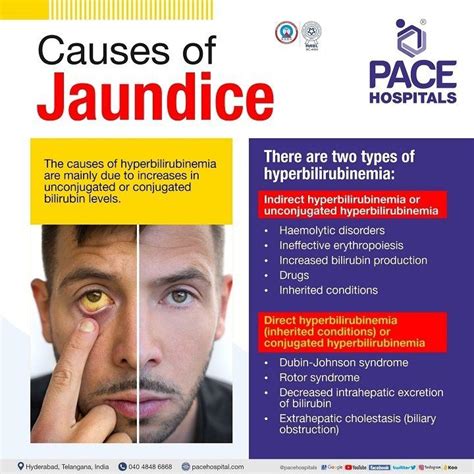 Jaundice Disease - Symptoms, Causes, Complications and Prevention