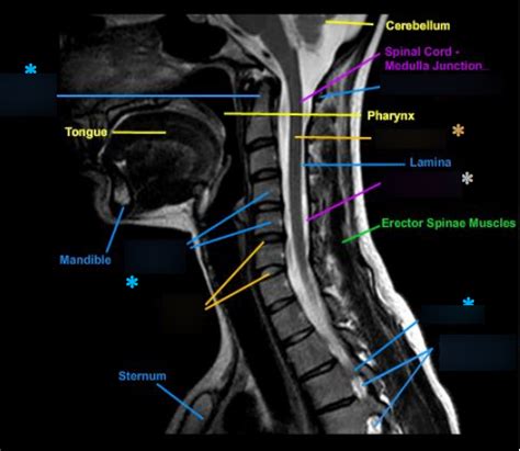 C Spine Anatomy |MRI Cervical Spine Sagittal Anatomy, 44% OFF