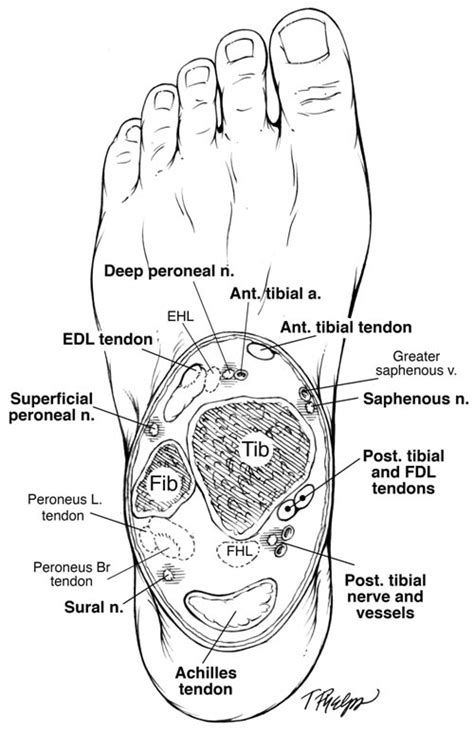 Ankle Block