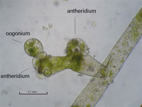 vaucheria (reproduction) - ALGUES microscopiques III - Mikroscopia