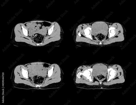 Abdomen ct scan and MRI professional images Stock Photo | Adobe Stock