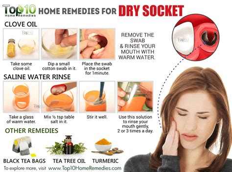 How To Clean Dry Socket With Syringe at yolandacheim blog