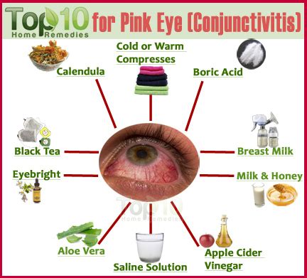 Home Remedies for Pink Eye (Conjunctivitis) | Top 10 Home Remedies