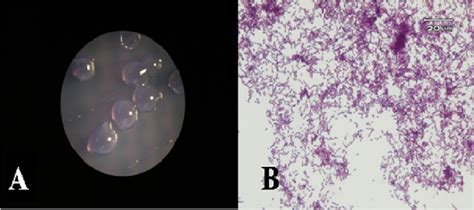 (A) Isolated oral Streptococcus from dental plaque in Mitis-Salivarius... | Download Scientific ...