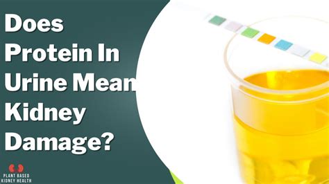 Urine Protein Test