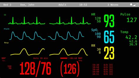 Monitoring Of Patient's Condition, Vital Signs On ICU Monitor In ...