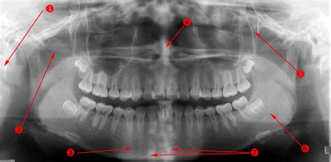 Oral Radiology : U of MN