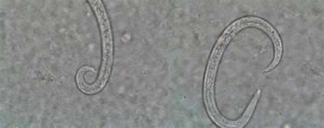 First stage larvae of Angiostrongylus vasorum, highlighting the tip... | Download Scientific Diagram