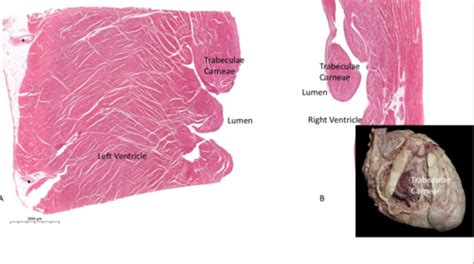 Trabeculae Carneae Histology