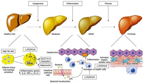 Vitamin D Deficiency And Liver Function