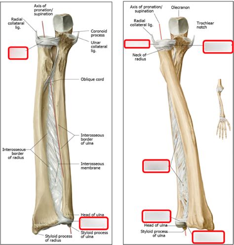 Distal Radioulnar Joint