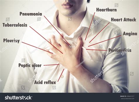 Chest Pain Causes Disease Diagram Stock Photo 436661017 - Shutterstock