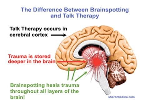 Brainspotting: Therapy for Rapid Change — Kelsey Ruffing Counseling 312.620.0714