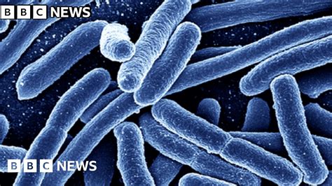 Les autorités canadiennes enquêtent sur une éclosion d'E. coli dans des garderies de Calgary