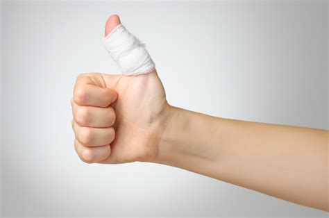 Sprained Thumb | Cause and Recovery Time | OrthoIndy Blog