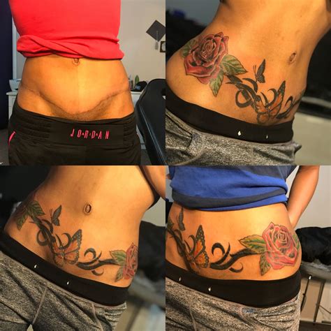 tummy tuck tattoos before and after - lineartdrawingsaestheticcouple